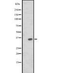 JAM2 Polyclonal Antibody