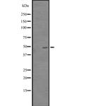 CREB3L3 Polyclonal Antibody