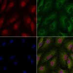 PKC lambda/iota Antibody in Immunocytochemistry (ICC/IF)