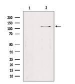 TAOK2 Polyclonal Antibody