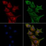 GPR30 Polyclonal Antibody