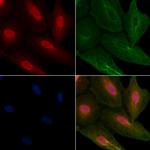 HnRNP Q Polyclonal Antibody