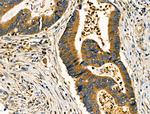 PRKCSH Antibody in Immunohistochemistry (Paraffin) (IHC (P))