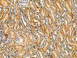 PRKCSH Antibody in Immunohistochemistry (Paraffin) (IHC (P))
