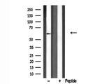 PRKCSH Antibody in Western Blot (WB)