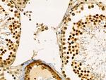 ATF1 Antibody in Immunohistochemistry (Paraffin) (IHC (P))