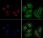 CRP1 Polyclonal Antibody