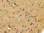 CRP1 Antibody in Immunohistochemistry (Paraffin) (IHC (P))