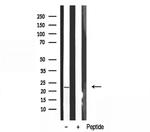 CRP1 Antibody in Western Blot (WB)