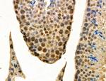 hnRNP F Antibody in Immunohistochemistry (Paraffin) (IHC (P))