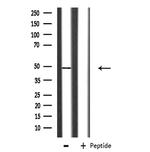 hnRNP F Antibody in Western Blot (WB)