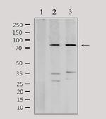 PFKP Polyclonal Antibody