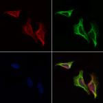 GIT2 Polyclonal Antibody