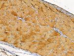 DOK4 Antibody in Immunohistochemistry (Paraffin) (IHC (P))