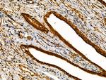 MKL1 Polyclonal Antibody