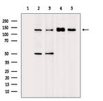 MKL1 Antibody in Western Blot (WB)