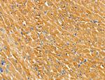 SLK Antibody in Immunohistochemistry (Paraffin) (IHC (P))