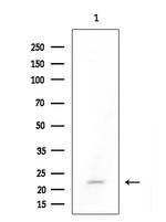 DUSP22 Antibody in Western Blot (WB)