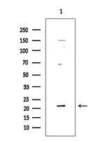 DUSP22 Polyclonal Antibody