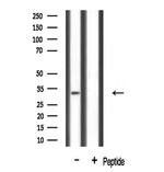 MLX Polyclonal Antibody