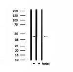 CMKLR1 Polyclonal Antibody