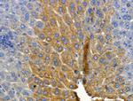 CYP2E1 Polyclonal Antibody