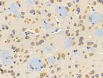 RPS4X Antibody in Immunohistochemistry (Paraffin) (IHC (P))