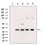 RPS4X Antibody in Western Blot (WB)