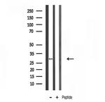 RPS4X Antibody in Western Blot (WB)