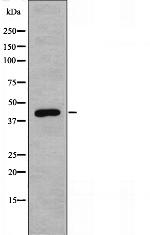 ACOT1 Antibody in Western Blot (WB)