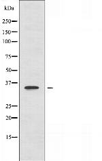ACOT8 Antibody in Western Blot (WB)