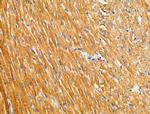 Arfaptin 1 Antibody in Immunohistochemistry (Paraffin) (IHC (P))