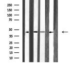 Arfaptin 1 Antibody in Western Blot (WB)
