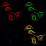 Arylsulfatase A Polyclonal Antibody