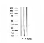 Calponin 2 Antibody in Western Blot (WB)