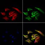 eIF3k Polyclonal Antibody