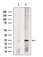 MED18 Polyclonal Antibody