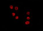 HELZ2 Antibody in Immunocytochemistry (ICC/IF)