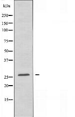 PRSS33 Antibody in Western Blot (WB)