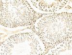 RAD23B Antibody in Immunohistochemistry (Paraffin) (IHC (P))