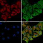 GIPR Polyclonal Antibody