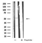 GIPR Antibody in Western Blot (WB)