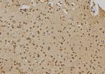 PTPN22 Polyclonal Antibody