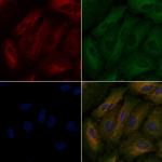 PCK1 Polyclonal Antibody