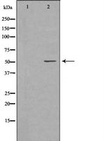 MMP8 Polyclonal Antibody