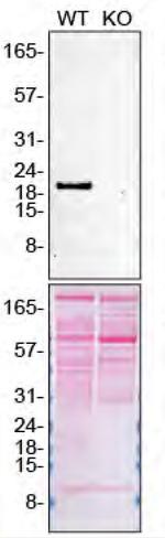 Pleiotrophin Polyclonal Antibody