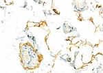 Perilipin 1 Antibody in Immunohistochemistry (Paraffin) (IHC (P))