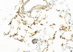 Perilipin 1 Antibody in Immunohistochemistry (Paraffin) (IHC (P))