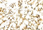 Perilipin 1 Antibody in Immunohistochemistry (Paraffin) (IHC (P))