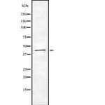 Creatine Kinase BB Polyclonal Antibody